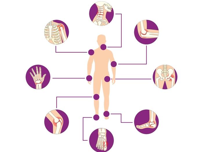 Arthritis in Youth: Why Do Young People Get Arthritis?